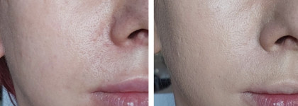 Когда лучшее — враг хорошего: тональная основа HD Liquid Coverage Foundation от Catrice в 10 оттенке (light beige)