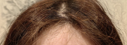 Знакомство: Openface Such A Big Peel