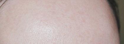 Гель Purito Defence Cleanser - Мой опыт применения на жирной коже