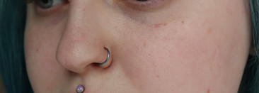 Макияж без макияжа. Скрываем покраснения