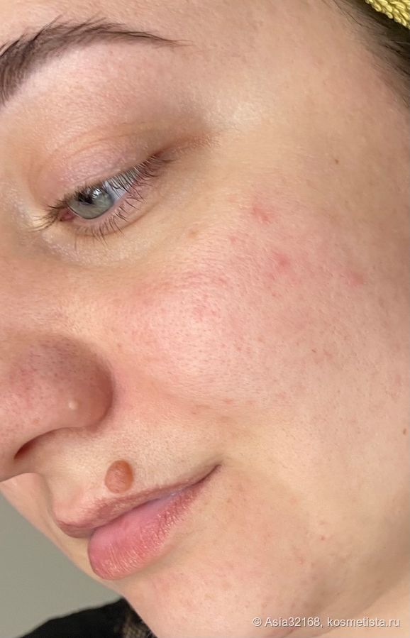 До использования средства