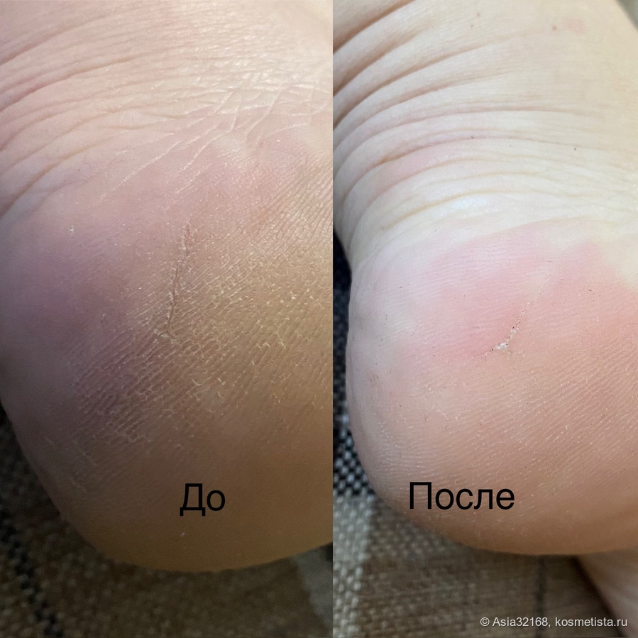 Спустя две недели использования