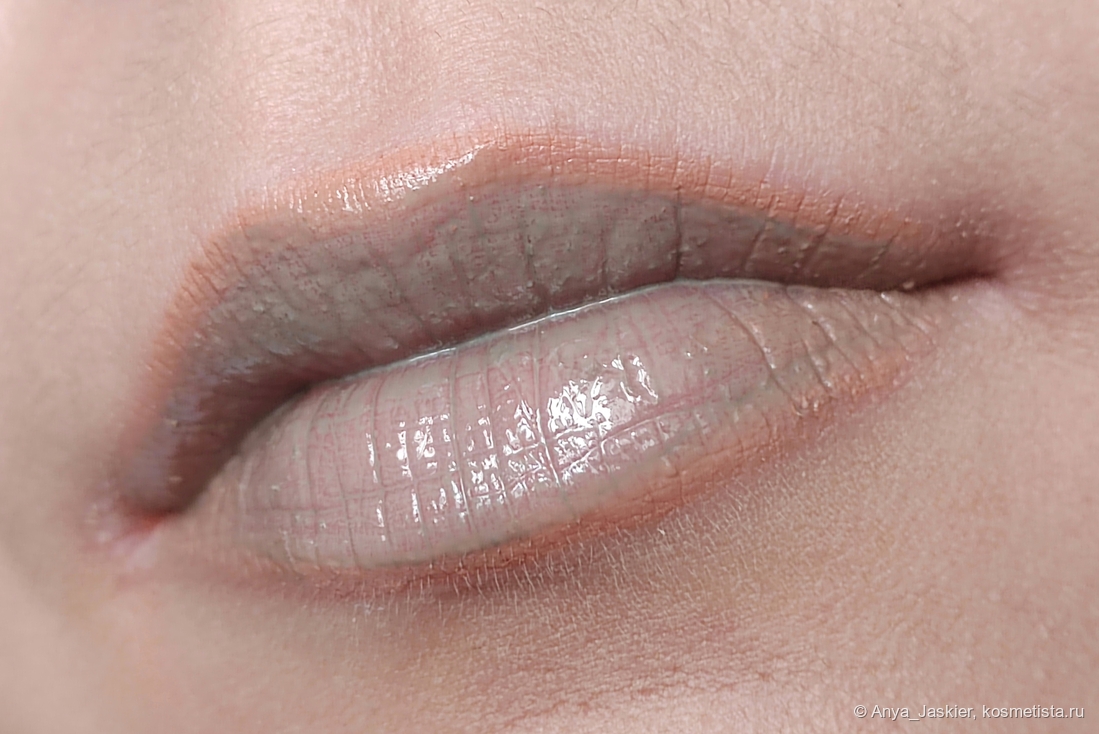 блеск зацепился за шелушения и сухие участки