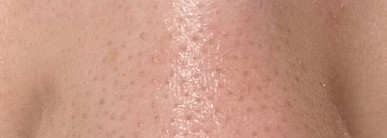 Чистые поры за 30 минут с продуктами Ciracle