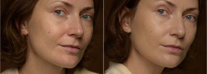 Своё лицо, только лучше: моя база