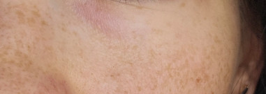 Экспресс метод для свежего взгляда: Suite by Julia Godunova Гидрогелевые патчи Stress Relieving one-the-go