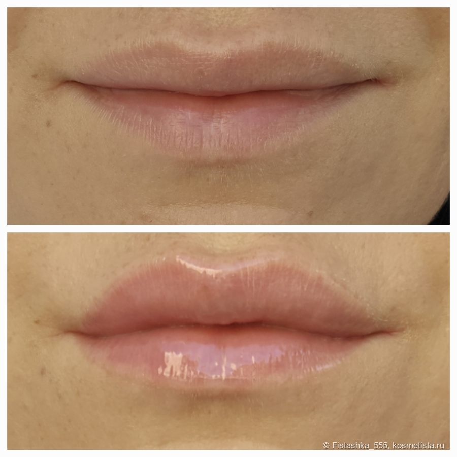 Плампер для губ Influence Beauty Lip Plumper Filler Cult. ДО и После