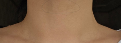 Борьба за упругость кожи шеи с Neovadiol Phytosculpt от Vichy