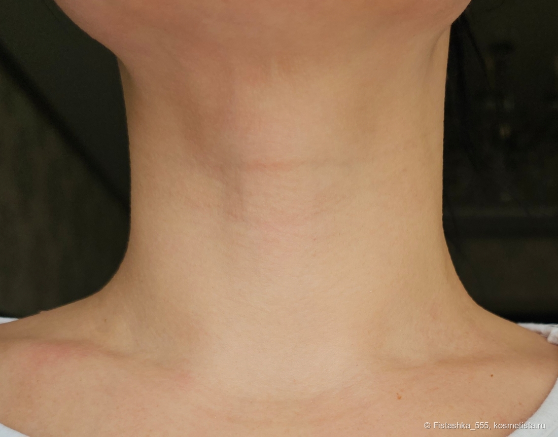 После массажа и нескольких часов с кремом Neovadiol Phytosculpt Neck