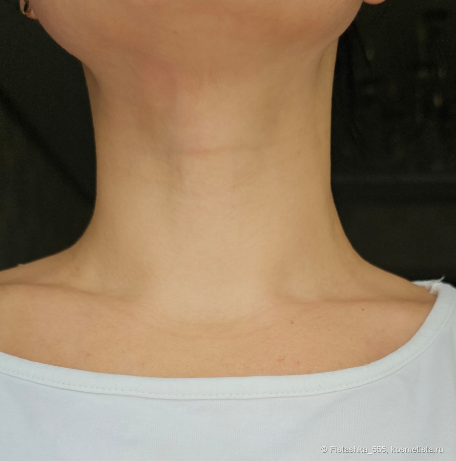 Результат применения Neovadiol Phytosculpt Neck & Face Contours