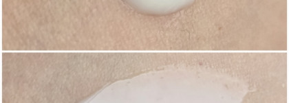 Redermic R гель-крем и сыворотка Retinol B3 La Roche-Posay. Моё знакомство с ретинолом