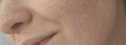 Redermic R гель-крем и сыворотка Retinol B3 La Roche-Posay. Моё знакомство с ретинолом