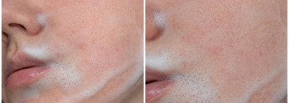 Russo Fabelo: два таких разных продукта для кожи