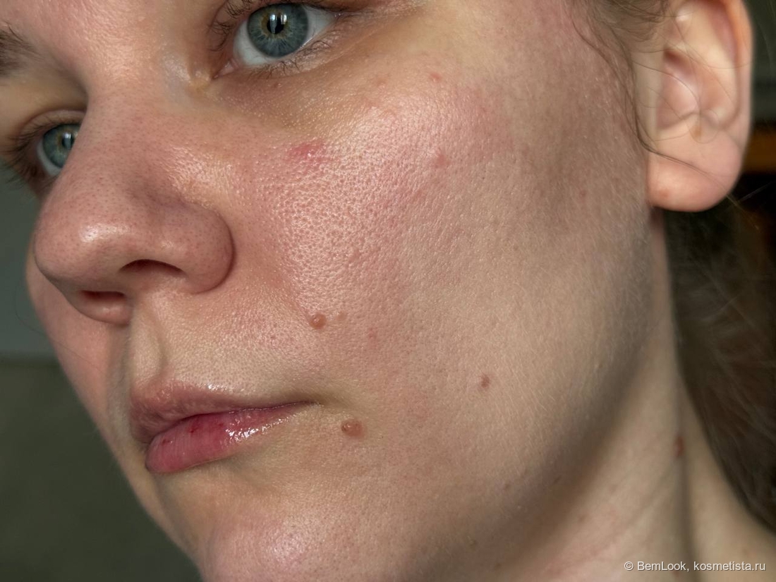 Кушон d'Alba Glow Fit Serum Cover Cushion на небольшом участке кожи лица