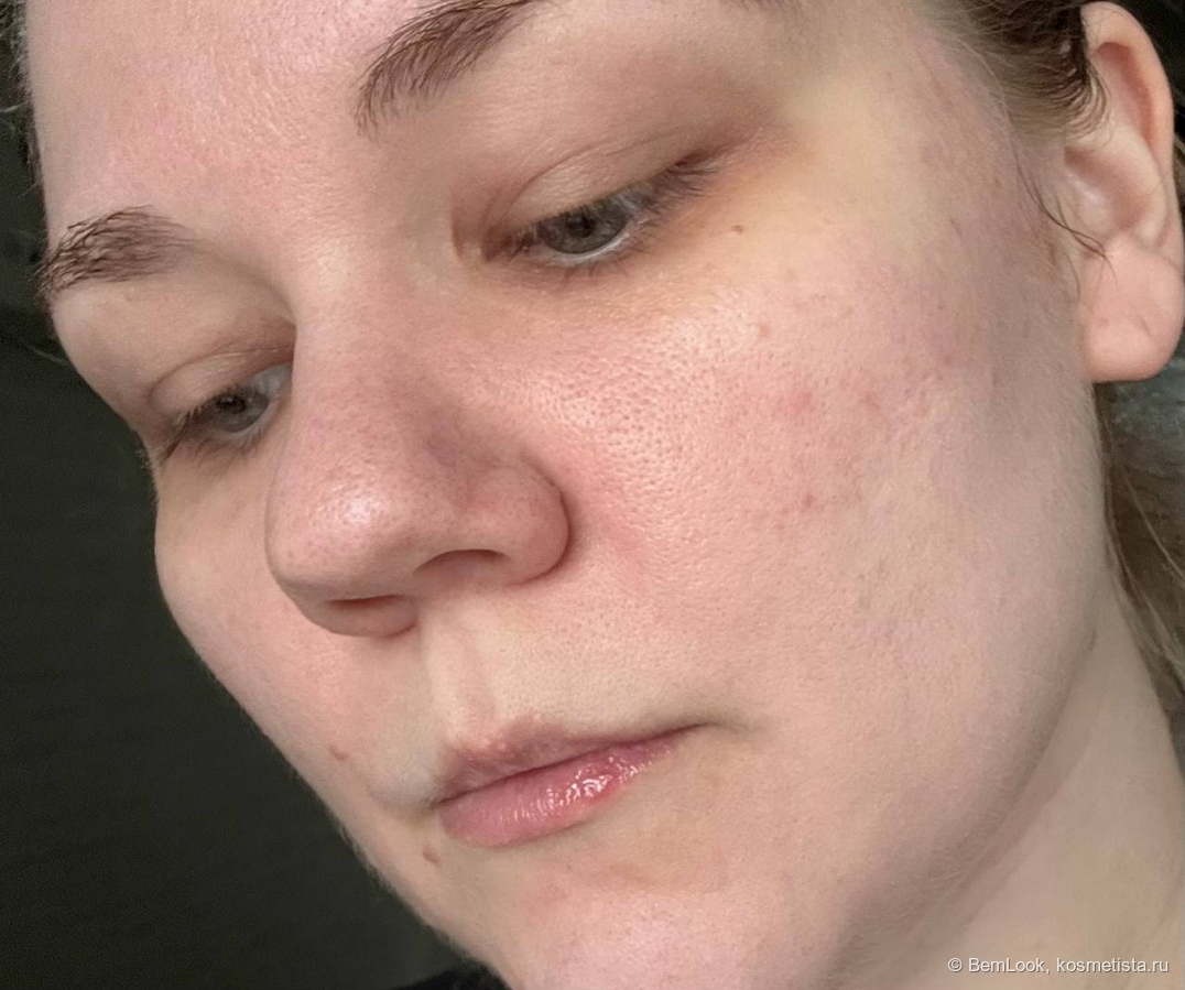 Тональный флюид TFIT Radiance Fit Serum Foundation в оттенке C01 Porcelain на половине щеки