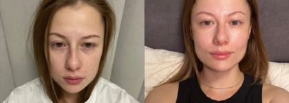 Ввод в уход пептидов на примере Booster Bar Lymfotonic Toner и Booster Bar Cream Multi-peptide