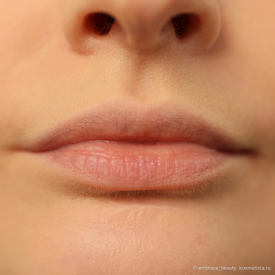 Мои губы без продукта, нанесла только тональный вокруг губ, чтобы сделать картинку визуально более приятной.