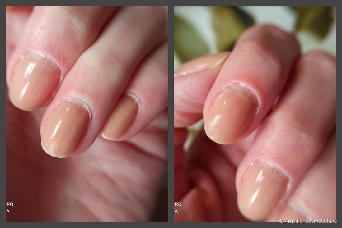 Маникюру 10 дней