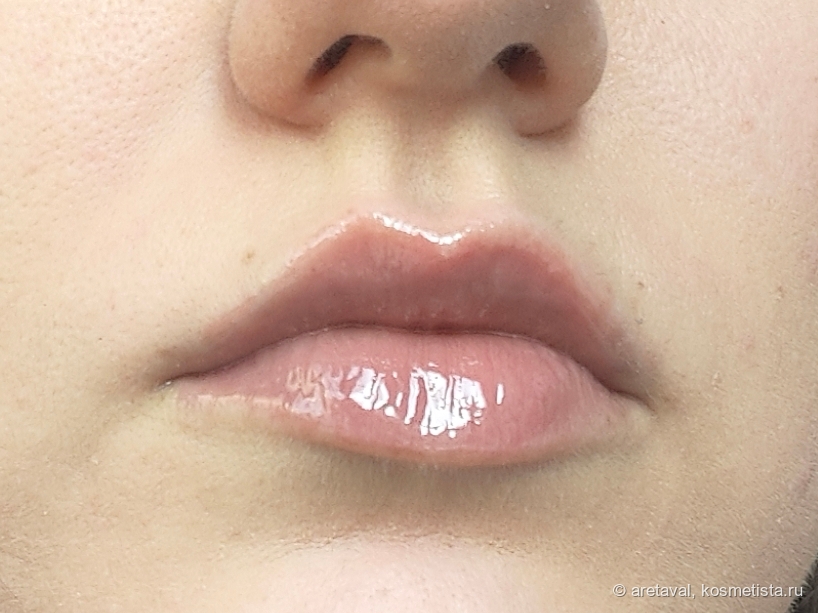 На обеих губах. Дневной свет