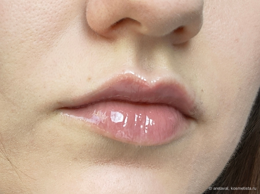 На обеих губах. Дневной свет