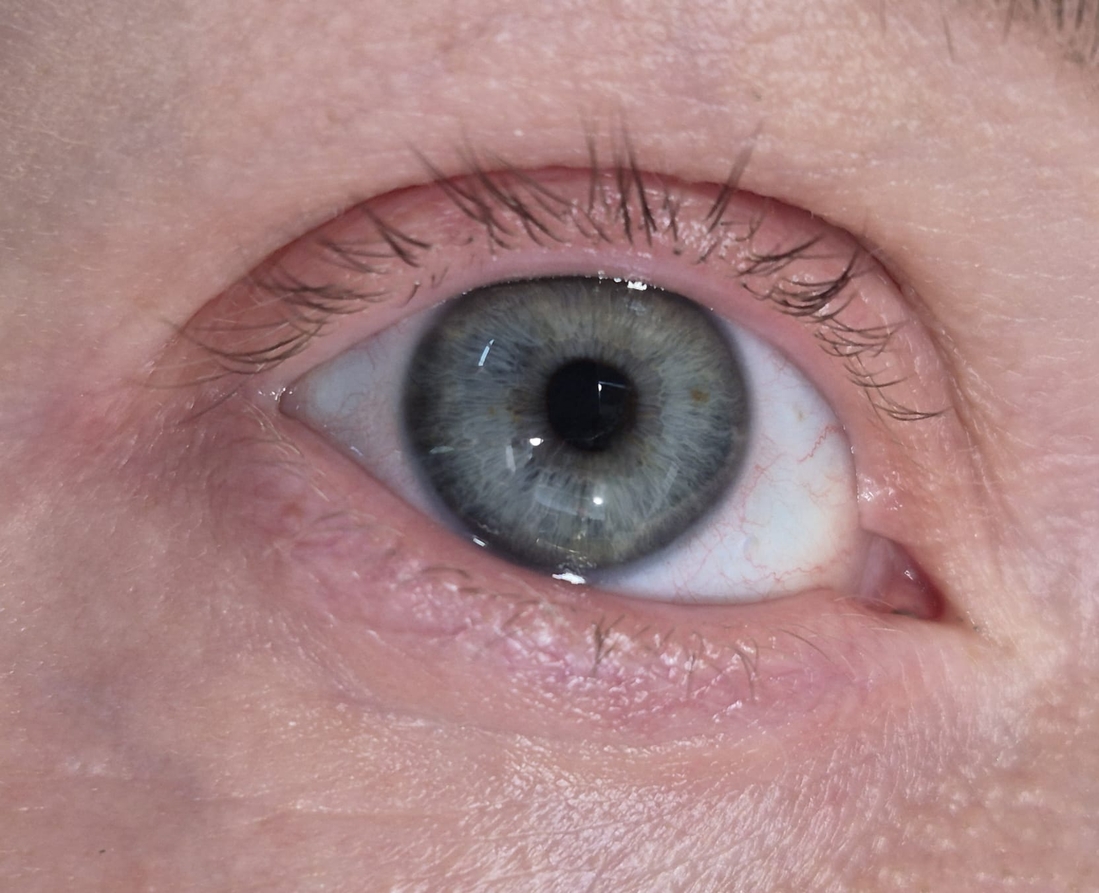 Ресницы есть, но их немного