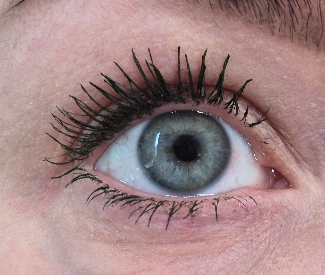 Стали появляться "лапки паучка"