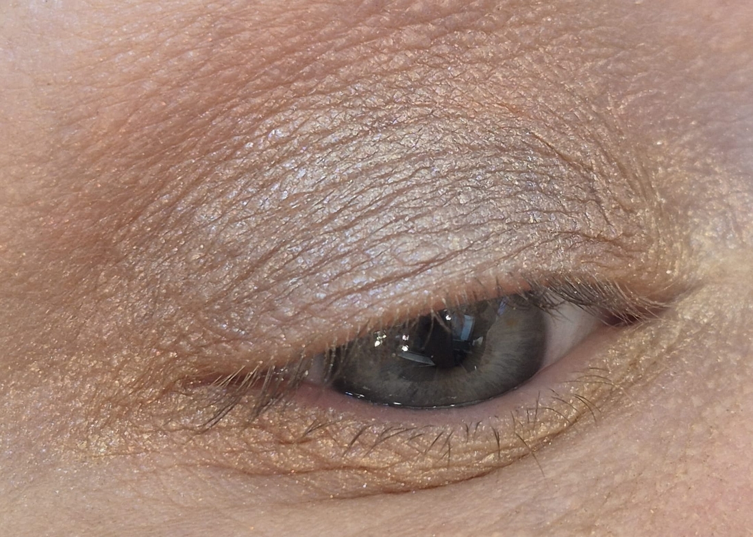 Тут на нижнем веке и на внетренний угол глаза