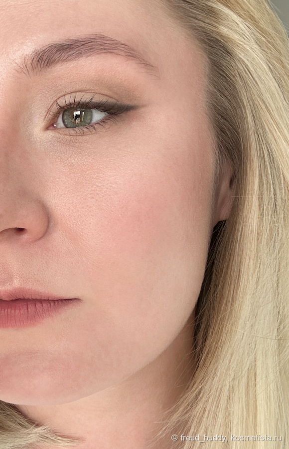 Bone на подвижном веке и внутреннем уголке, Birch в складке и на нижнем веке