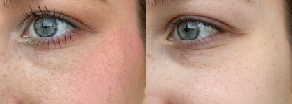 Очищение высохшего атопика: лучшая крем-пенка Real Barrier Cream Cleansing Foam