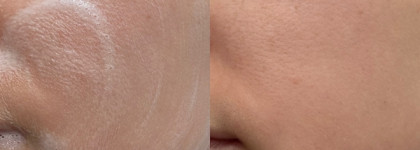 Очищение высохшего атопика: лучшая крем-пенка Real Barrier Cream Cleansing Foam