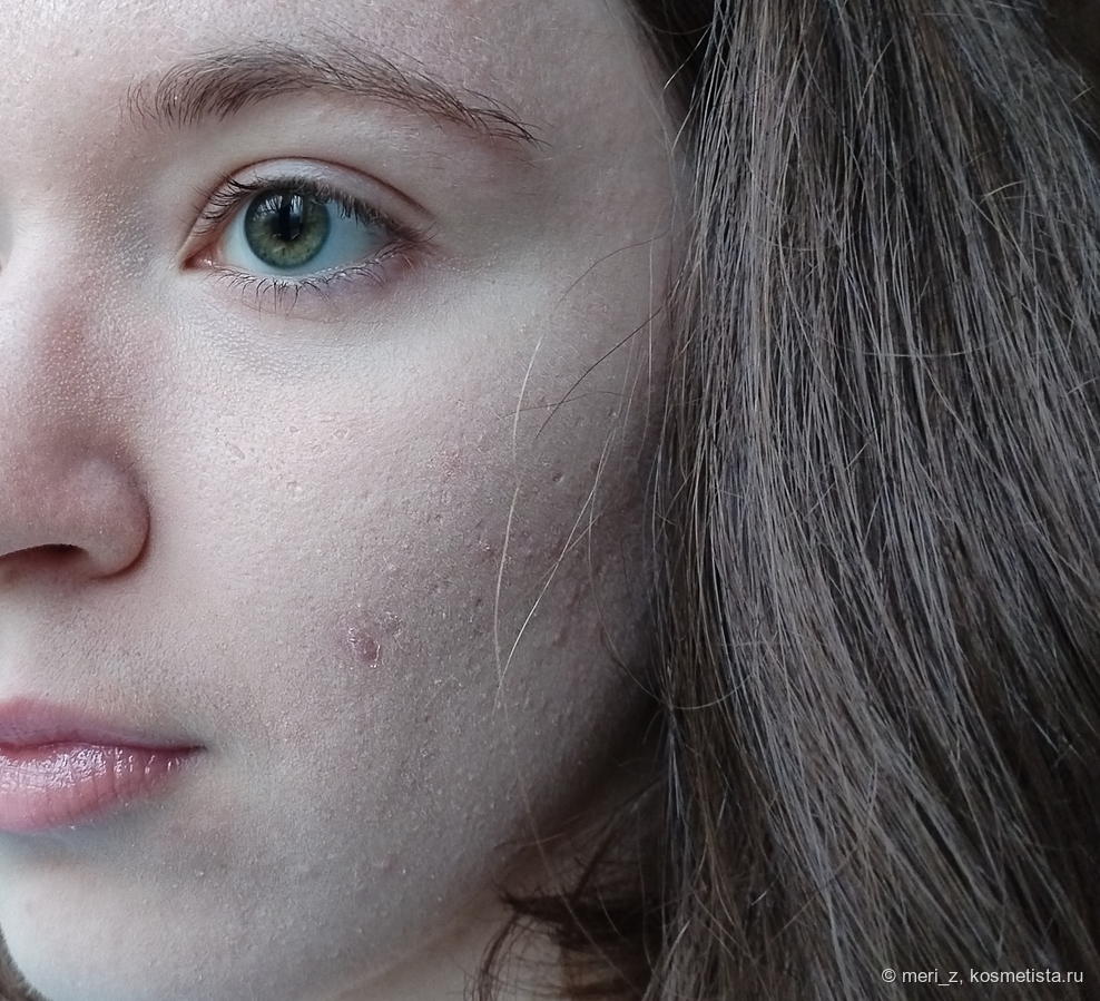 ПОСЛЕ, дневной свет