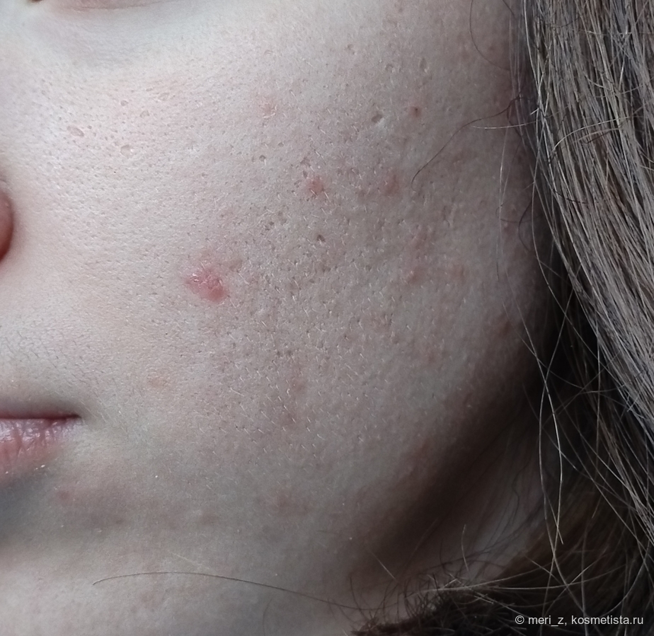 ДО, дневной свет