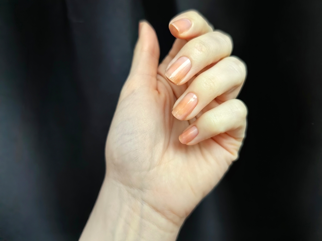 Два слоя. Ситуация стала чуть лучше.