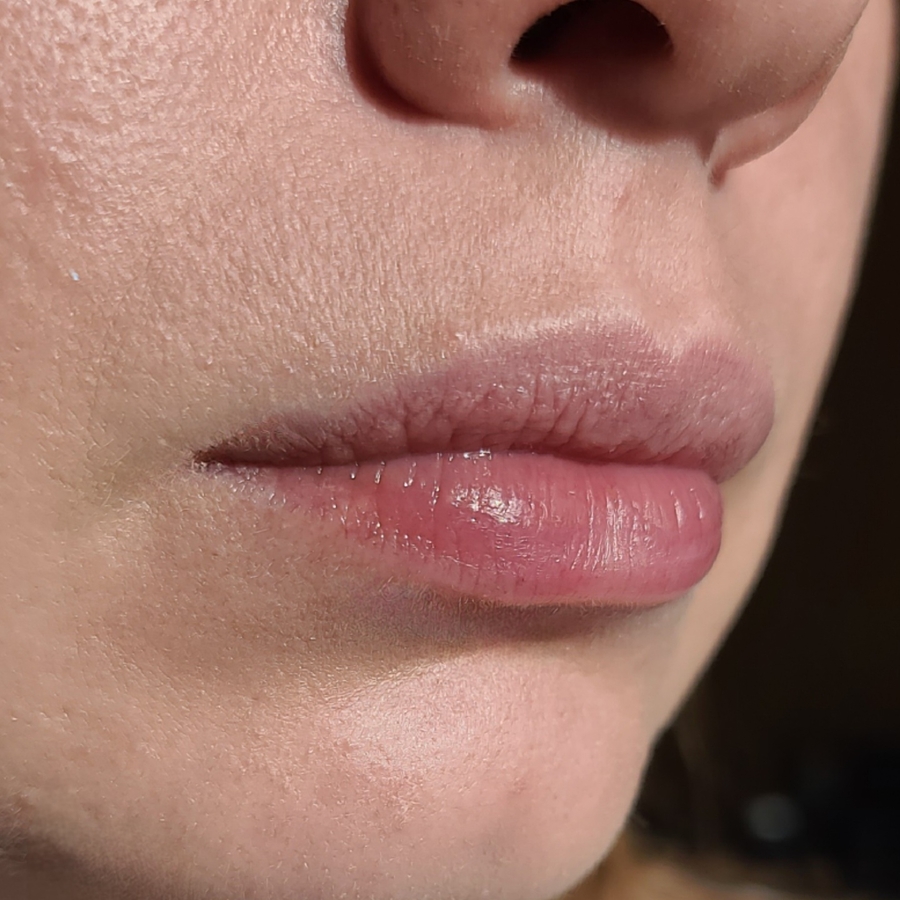 До бальзама