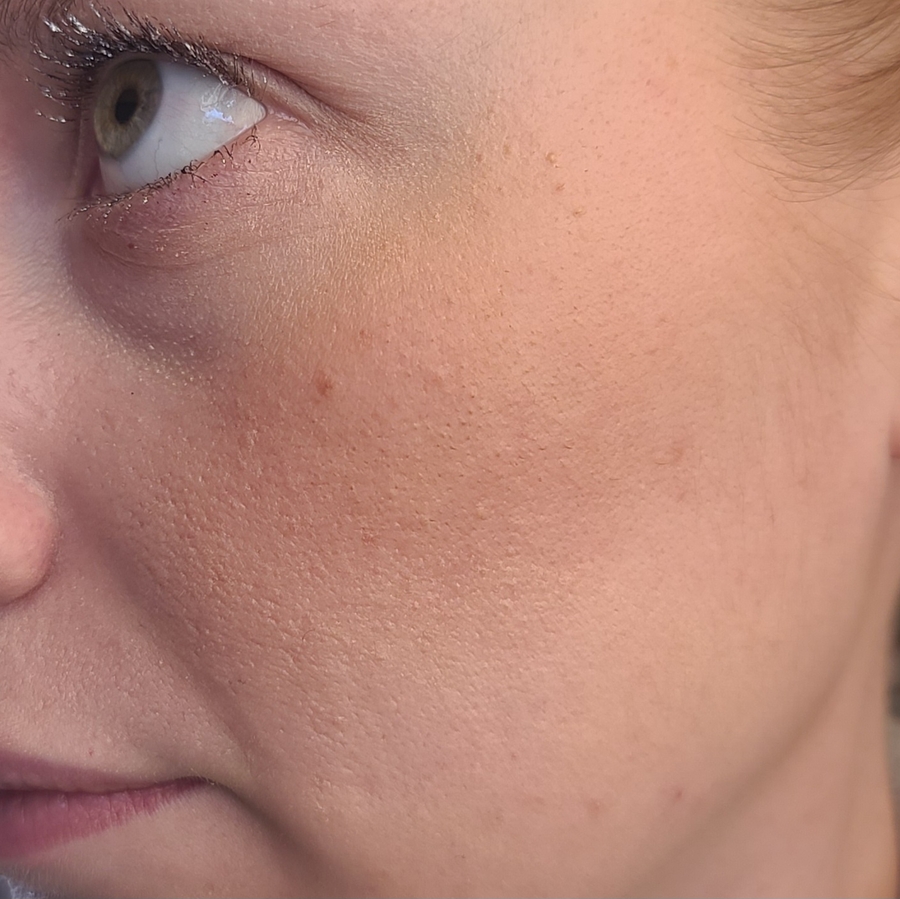 И фото без солнечных лучей