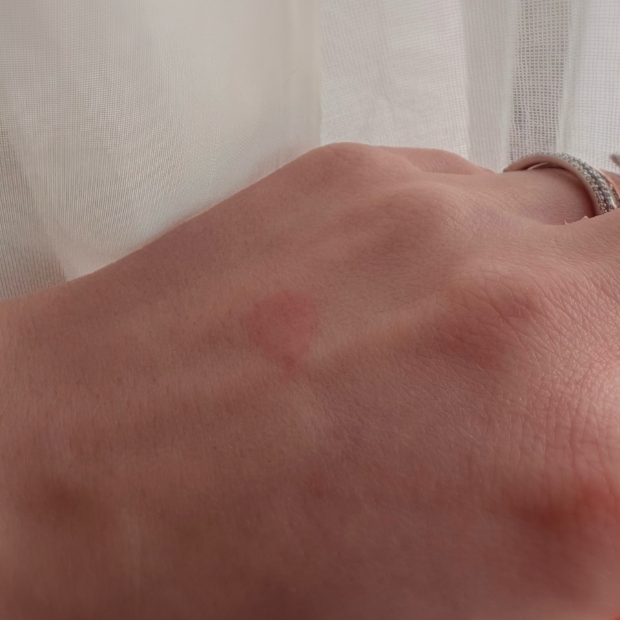 Тест на коже при дневном свете