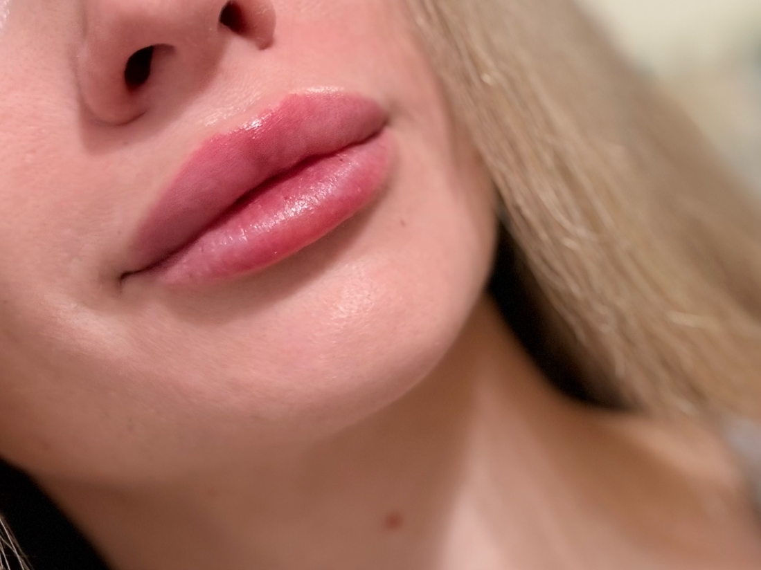 Несколько часов после нанесения