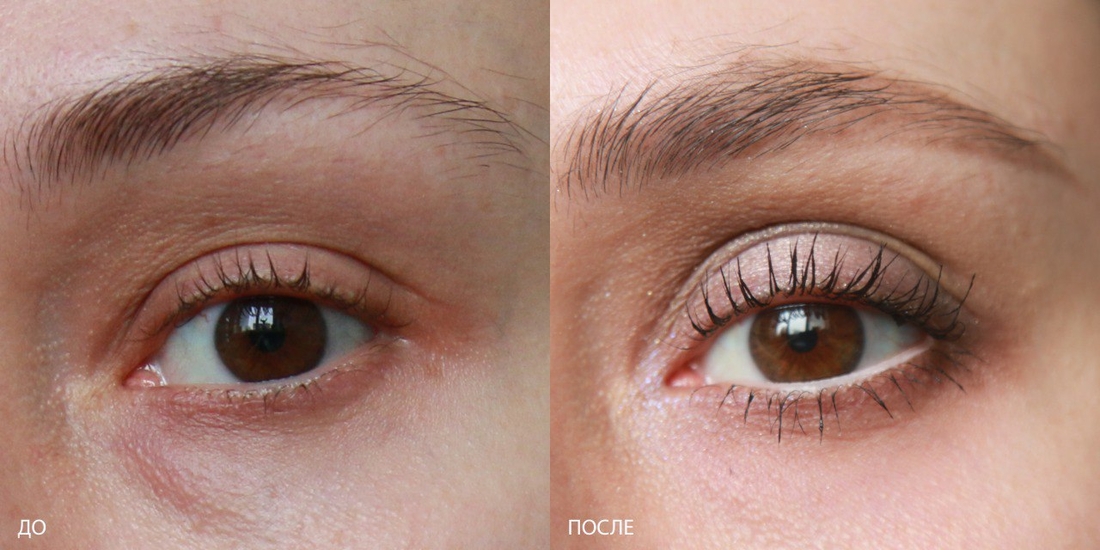 Фото использования до и после