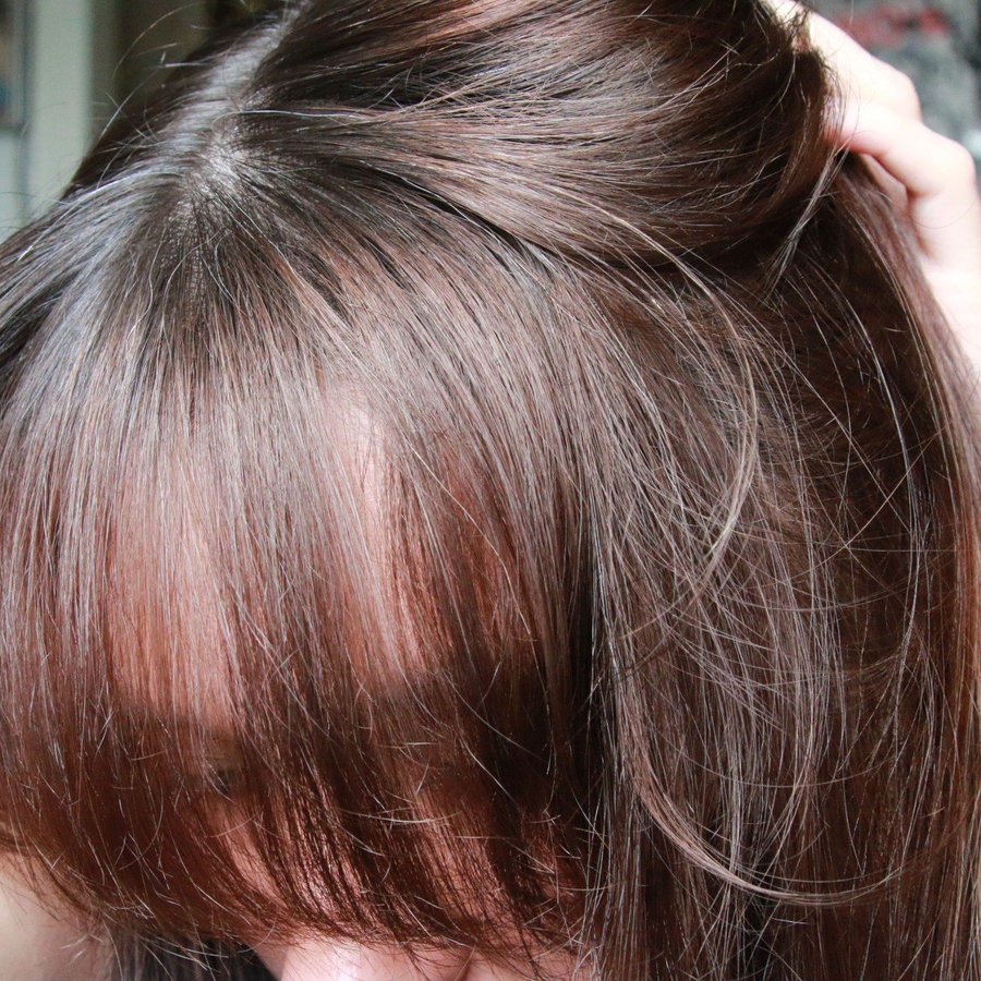 Вид корневого объёма