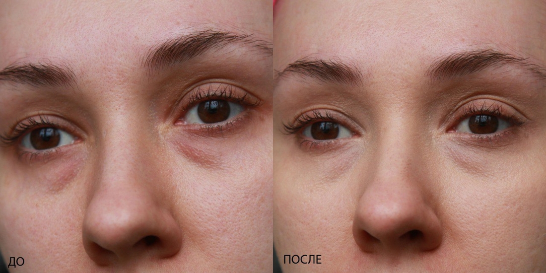 Результаты нанесения до и после