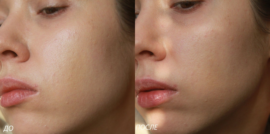 Результаты до и после