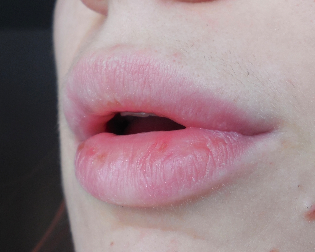 Губы как они есть