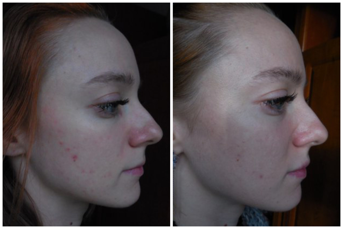 Было - стало