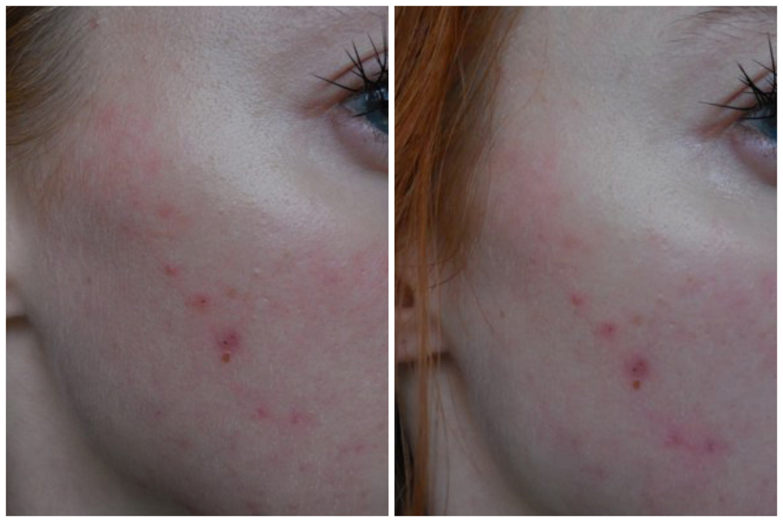 До умывания и после