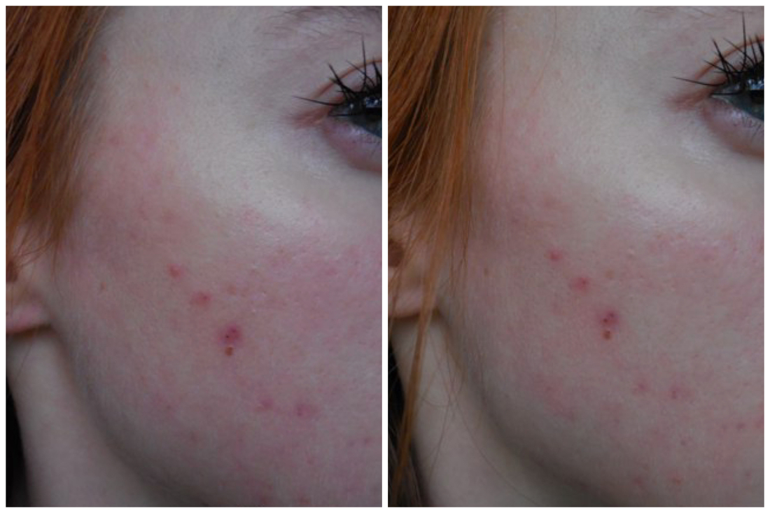 Умылась и нанесла тоник (фото слева), нанесла крем (справа)