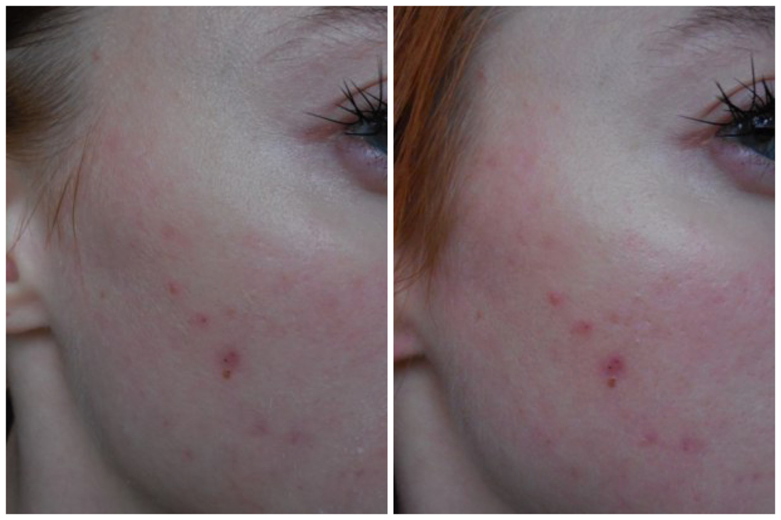 Слева после умывания и до нанесения тоника, справа - после того как потёрла лицо тоником