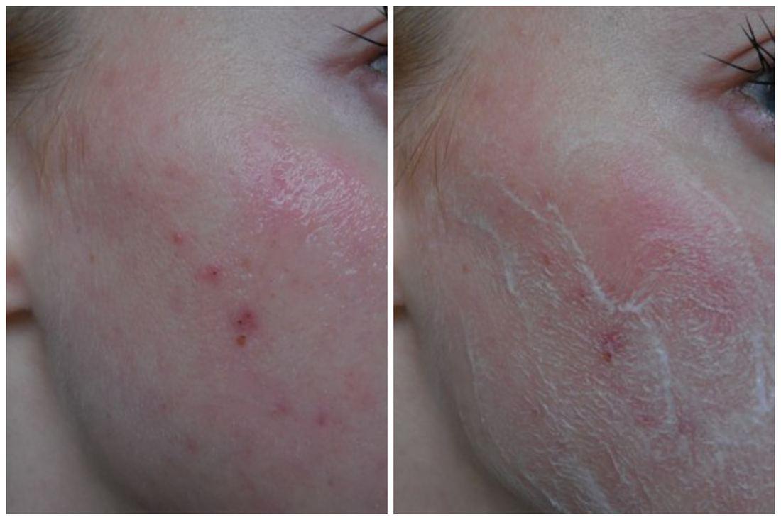 Пенообразование