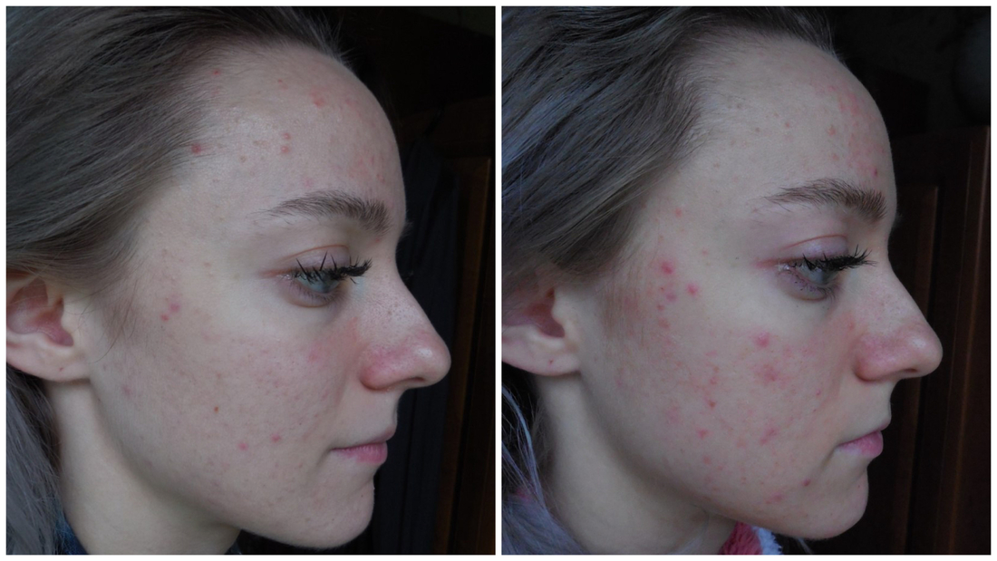 Эффект от этого крема