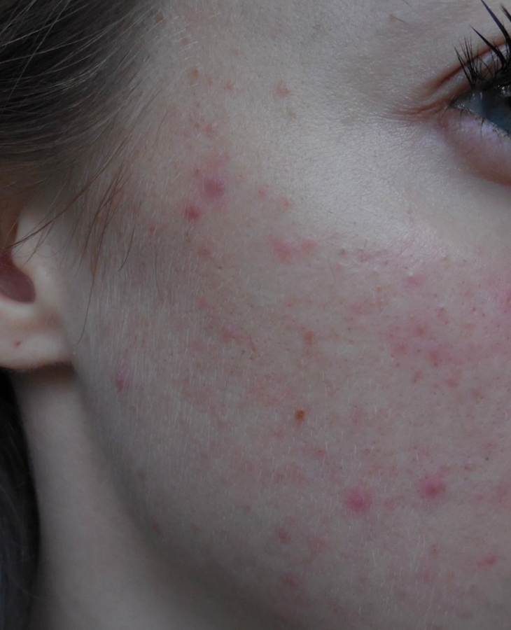 Через 10 минут после нанесения