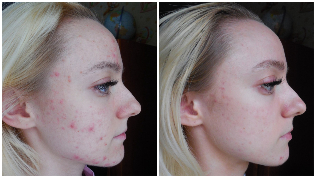 Эффект от другого средства за аналогичный период времени